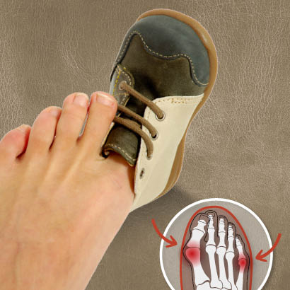 Gesundheitliche Folgen von zu kleinen und zu groen Schuhen